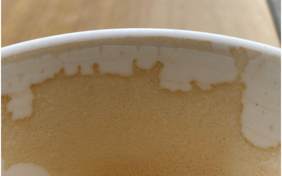 Was haben wir nicht schon alles begraben?